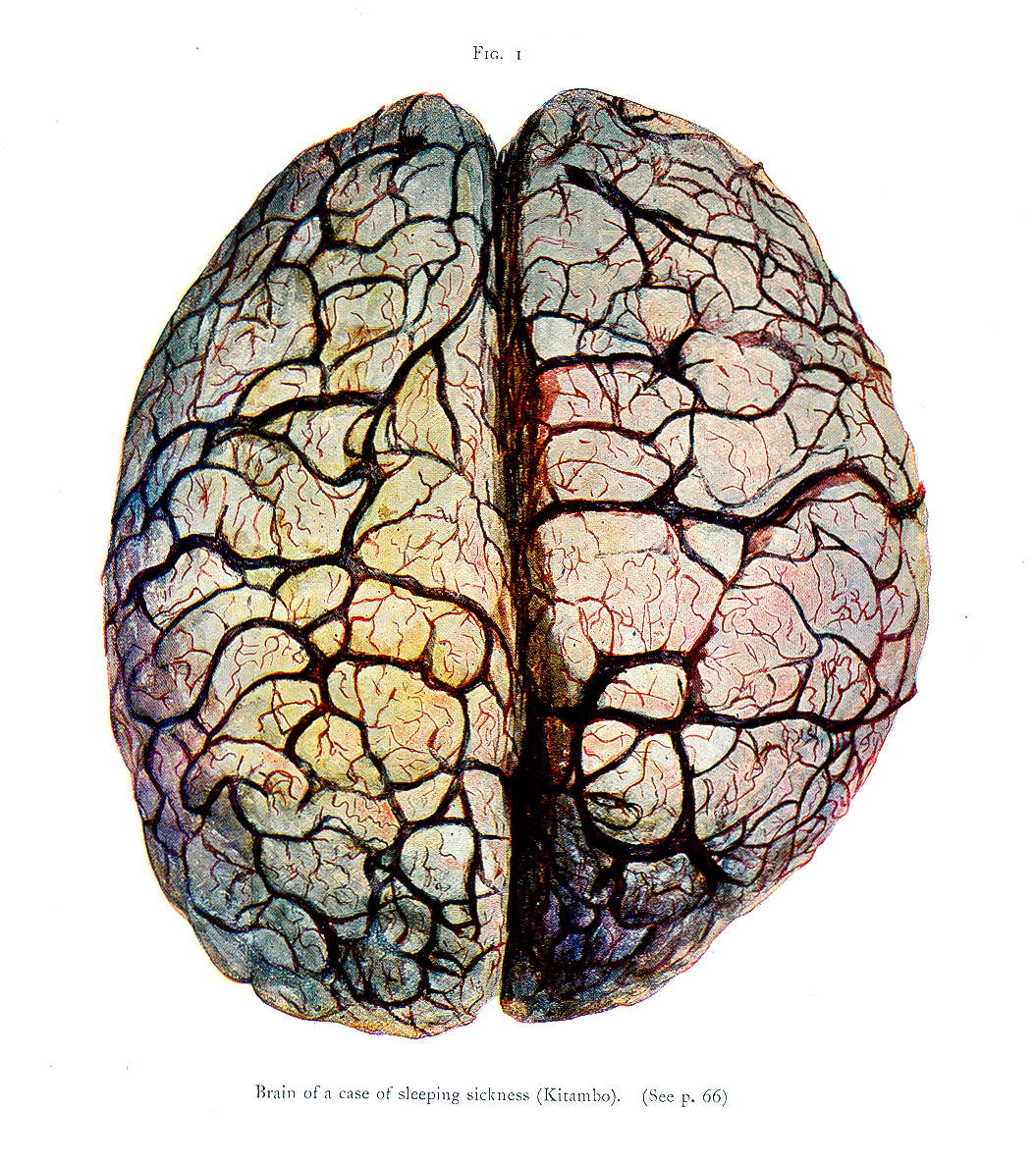 Thomas-Breinl-1905-necropsie-brain1