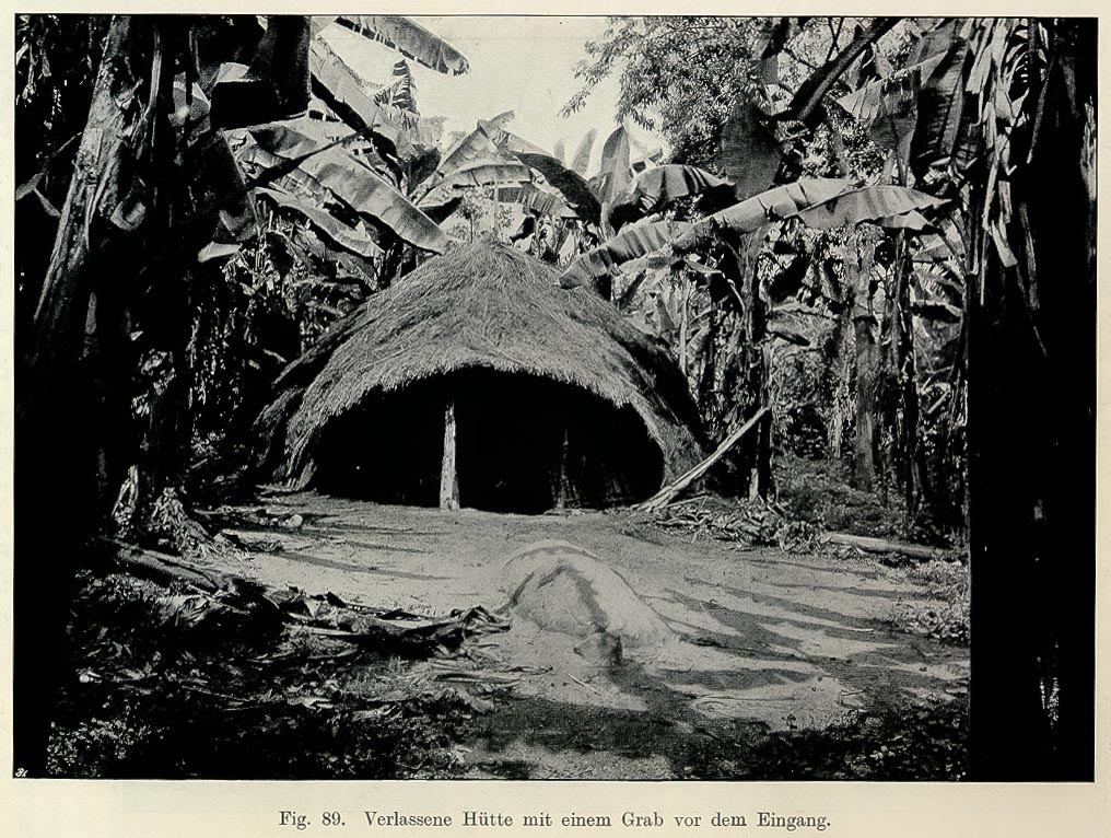 Maladie du sommeil